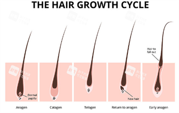 單毛囊移植過(guò)程圖解