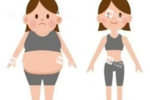 吸脂卡通對比圖 吸脂卡通對比圖