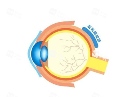 后鞏膜加固的部位