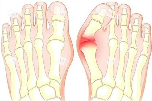 大腳骨腳步骨頭透視圖