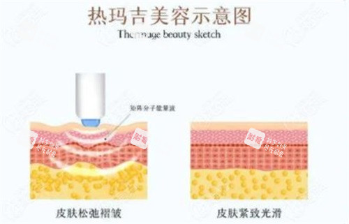 深圳何德文醫(yī)生簡介:坐診伽美貝拉,熱超聯(lián)合抗衰技術(shù)靠譜口碑佳!