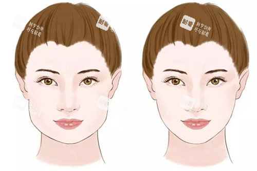 瘦臉卡通對比圖