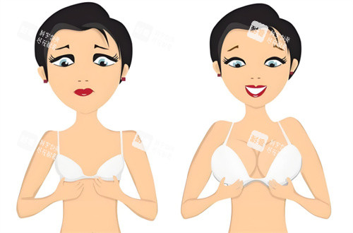 隆胸對比圖 隆胸對比圖