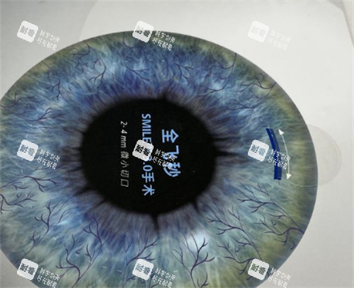 濟南麥迪格眼科全飛秒手術(shù)介紹