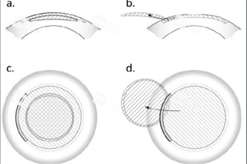 全飛秒過程 全飛秒過程