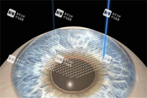 徐州眼科飛秒手術(shù)價(jià)格2025年行情：半飛秒、全飛秒手術(shù)費(fèi)用區(qū)間詳解！