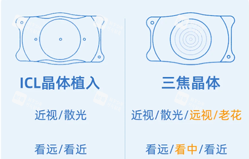 ICL和三焦晶體示意圖