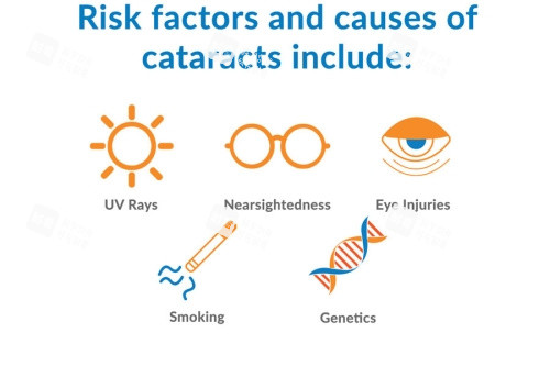 白內(nèi)障病因 白內(nèi)障病因