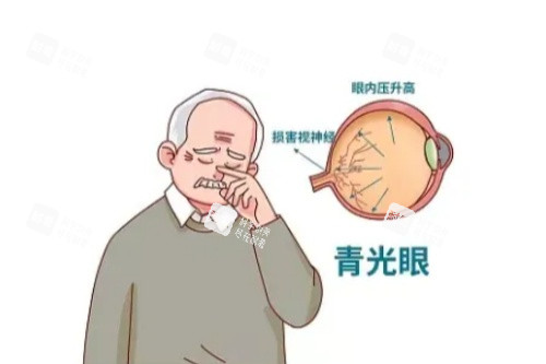 青光眼卡通一覽圖