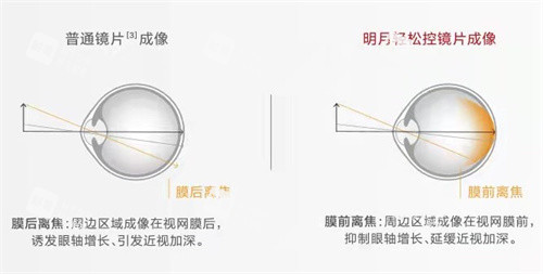 明月輕松控鏡片成像