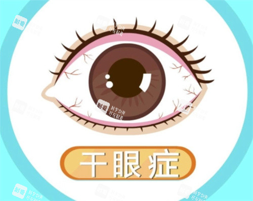 干眼癥照片