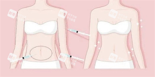 人魚體雕術(shù)前后對比