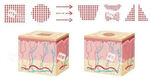 點陣激光出光模式