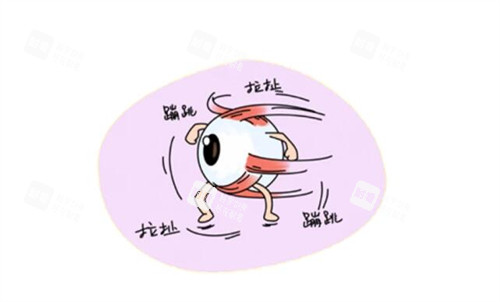為什么會出現(xiàn)眼球震顫