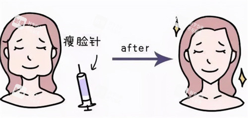 瘦臉注射前后卡通 瘦臉注射前后卡通