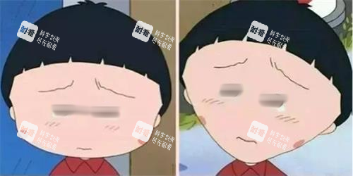 打針瘦臉前后明顯對比圖 打針瘦臉前后明顯對比圖