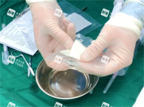 陰莖生物補片包裝