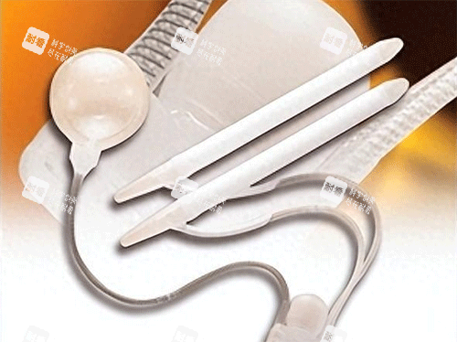 男性陰莖假體植入手術