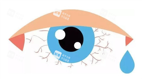 眼睛干澀 眼睛干澀
