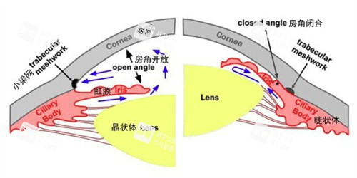 青光眼和正常眼睛的對(duì)比 青光眼和正常眼睛的對(duì)比