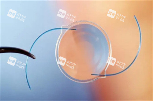 白內(nèi)障人工晶體 白內(nèi)障人工晶體