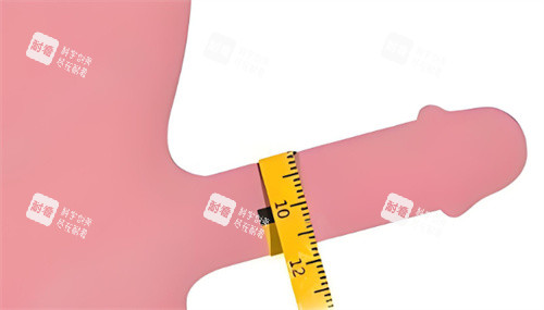 男性增大增粗手術(shù) 男性增大增粗手術(shù)