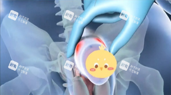 增大增粗手術(shù)照片 增大增粗手術(shù)照片