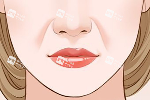 面部法令紋卡通示意圖 面部法令紋卡通示意圖