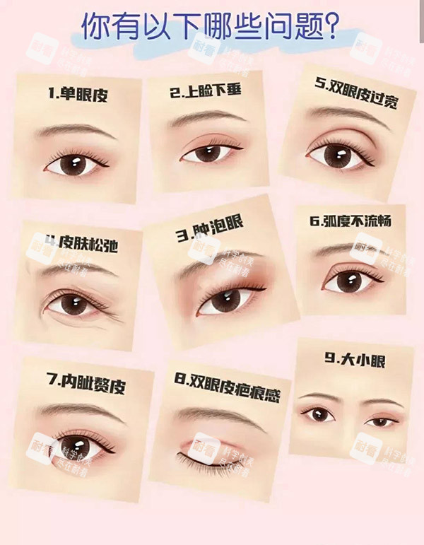 雙眼皮類型圖片 雙眼皮類型圖片