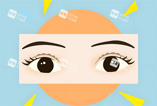 雙眼皮睜開圖 雙眼皮睜開圖