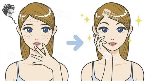 廣州痘坑修復(fù)哪家好？預(yù)算5K，糾結(jié)高尚李翠華超皮秒/荔灣皮膚，專攻vs全效覆蓋不一樣！