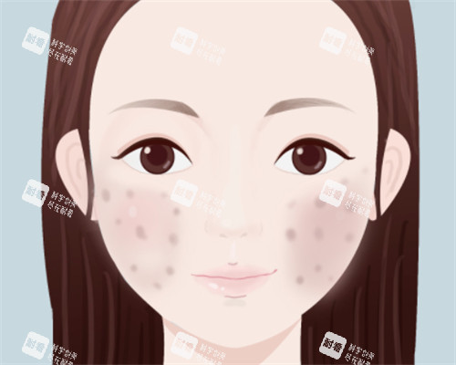臉上痘印怎么辦 臉上痘印怎么辦