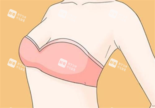 隆胸術(shù)后成效圖