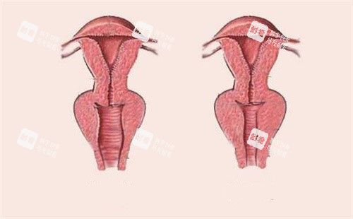 女性陰道松弛和緊致對(duì)比 女性陰道松弛和緊致對(duì)比