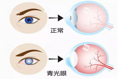 光明眼科VS愛(ài)爾眼科哪家強(qiáng)？?jī)杉艺?guī)連鎖眼科各有特色，近視手術(shù)選擇困難癥看過(guò)來(lái)！