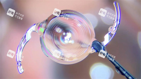 白內(nèi)障晶體示意圖