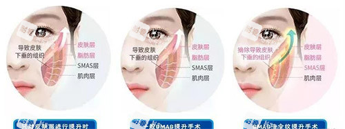 韓國(guó)江南詩(shī)麗雅皮膚科貴嗎？針劑注射+激光抗衰實(shí)力解析，預(yù)約方式全攻略！