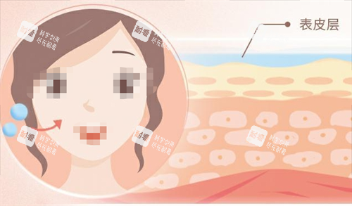 玻尿酸面部注射動(dòng)畫(huà)以及皮膚表面 玻尿酸面部注射動(dòng)畫(huà)以及皮膚表面