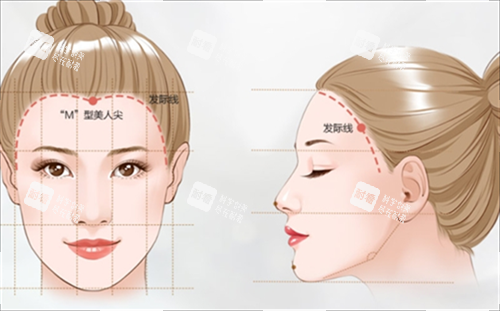 M型發(fā)際線素材 M型發(fā)際線素材