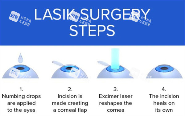 杭州太學(xué)眼科怎么樣？超可靠！設(shè)備靠前醫(yī)師實力出眾，近視矯正方案個性化，術(shù)后體驗佳
