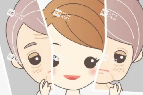 面部提升卡通展示圖 面部提升卡通展示圖