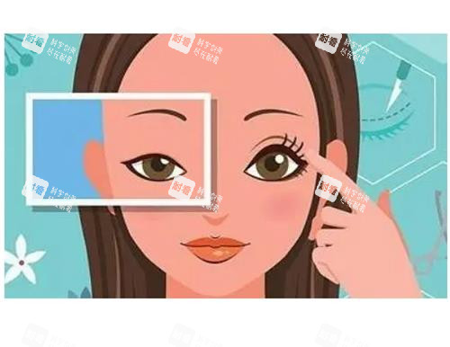 北京王恒內(nèi)眼角修復(fù)怎么樣？擅長過寬/外翻/疤痕，對癥方案不盲目