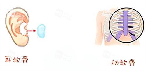 一文說清耳軟骨隆鼻放置部位：不止墊鼻尖，這些位置也能塑形