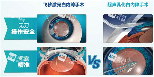 飛秒激光白內(nèi)障手術(shù)和超聲乳化白內(nèi)障手術(shù)區(qū)別
