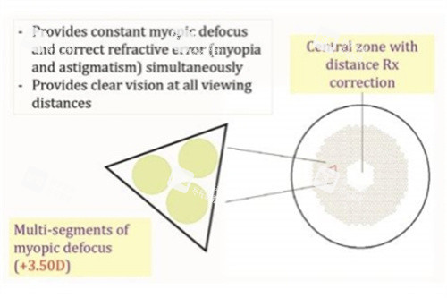 離焦鏡片原理圖