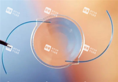 白內(nèi)障晶體照片