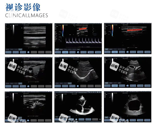 維密金雕影像照片