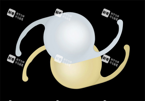 愛爾康DFT015晶體怎么樣？單焦價(jià)格享延伸景深|遠(yuǎn)中視力優(yōu)越+近視力夠用