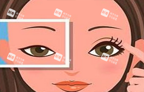 雙眼皮對比 雙眼皮對比