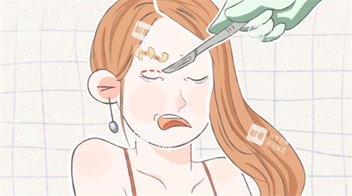 雙眼皮手術失敗修復卡通圖片